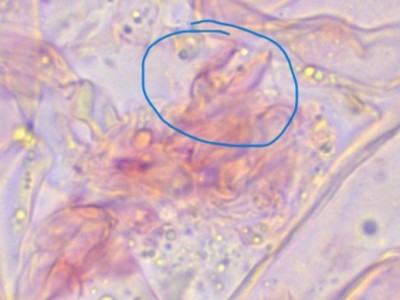 Daleomyces Haken_1_CR_1000_1.jpg