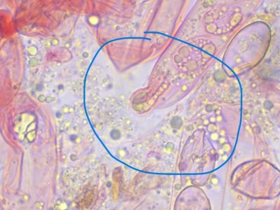 Daleomyces Haken2_CR_1000_2.jpg