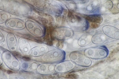 Daleomyces exogelatinosus mikr (3).JPG