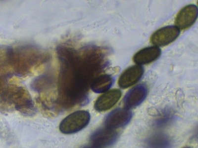 03 Coniochaeta ligniaria H2O_1000_4.jpg