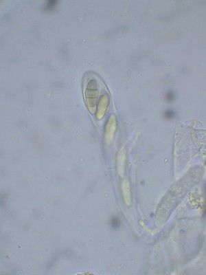 02 Phaeosphaeria lycopodina H2O_1000_1.jpg