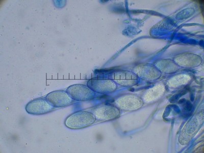 03 Scutellinia scutellata sporen masstab.jpg