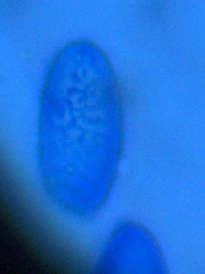 04 Scutellinia scutellat CB_1000_1_.jpg
