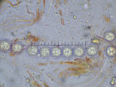 04 Scutellinia trechispora Sporen masstab.jpg