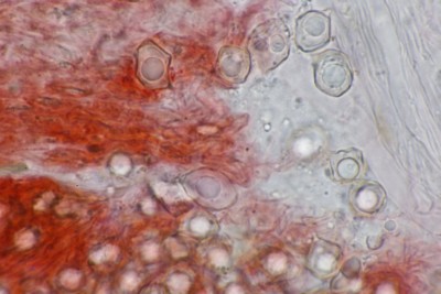Entoloma serrulatum mikr (2).JPG