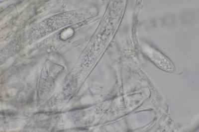 Hymenoscyphus trichosporus mikr (1).JPG