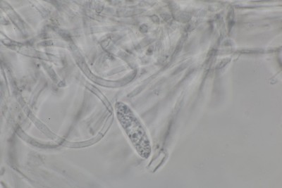 Hymenoscyphus trichosporus mikr (10).JPG