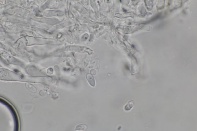 Xylodon crustosus mikr (1).JPG