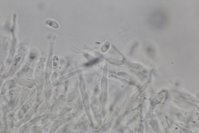 Xylodon crustosus mikr (20).JPG