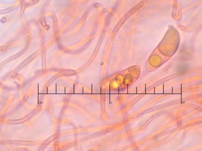 03 Ditiola peziziformis masstab CR_1000_8.jpg