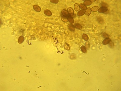 Cheilozystiden: lecithiform