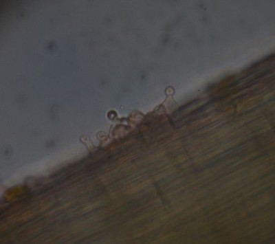 IMG_1020 Kaulozystiden Forum.JPG