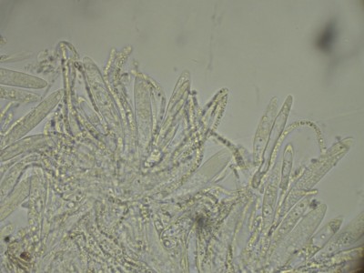 Diplonaevia emergens_Paraphysen.jpg