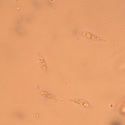 Melanconis alni_sporen.jpg