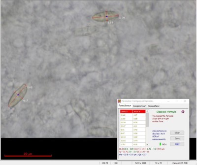 Xerocomus MikrMaße.jpg