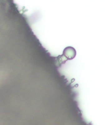 "intakte" Zystide mit "Schleimkappe"