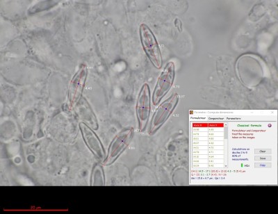 Lepiota oreadiformis aff. Sporenmaße.jpg