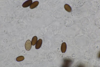 Coprinopsis cortinata mikr (2).JPG