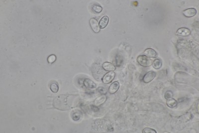 Lepiota clypeolarioides mikr (2).JPG