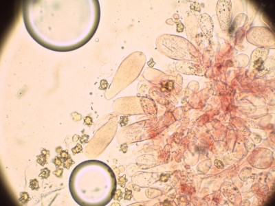 Inocybe turfae_Kongo_400_1.jpg