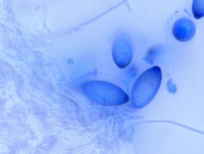 Sporen in Baumwollblau